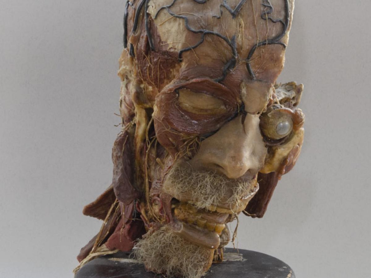 Anatomy collection - Anatomical wax, head of Graffeo, first half of the 19th century